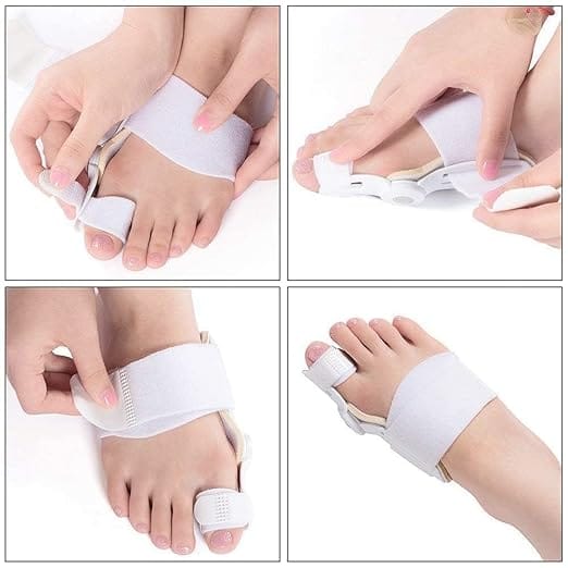 Plastic Bunion Splint Pad,Toe Straightener Bunion Corrector Splint With Toe Fracture Support (2pcs)